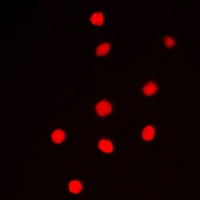 Anti-Cyclin E1 Antibody