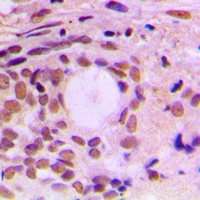 Anti-Cyclin F Antibody