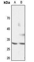 Cyclin G1 Rabbit Polyclonal Antibody
