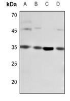 CD8a Rabbit Polyclonal Antibody