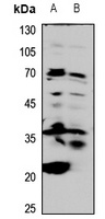 CD20 Rabbit Polyclonal Antibody