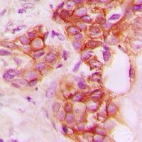 Anti-CD40 Antibody