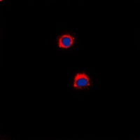 Anti-CD40 Antibody