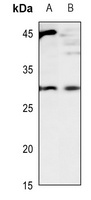 CD70 Antibody