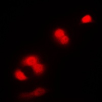 Anti-CDC2 Antibody