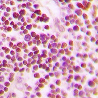 Anti-CDC25A (Phospho-S75) Antibody