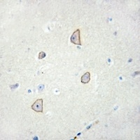 Anti-Cadherin 18 Antibody