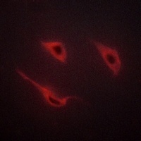 Anti-Cadherin 18 Antibody
