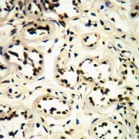 CDK1/2/3 (phospho-T14) antibody