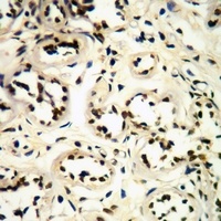 Anti-CDK1/2/3 (Phospho-T14) Antibody