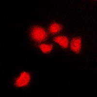 Anti-CDK1/2/3 (Phospho-T14) Antibody