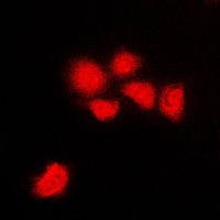 CDK1/2/3 (phospho-T14) antibody