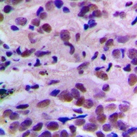 CDK2 (Phospho-T160) Antibody