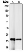 p21 Rabbit Polyclonal Antibody