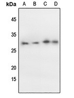 p27 Kip1 (Phospho-T198) Antibody