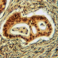 Anti-p27 Kip1 (Phospho-T198) Antibody