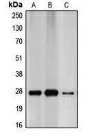 p27 Kip1 Rabbit Polyclonal Antibody