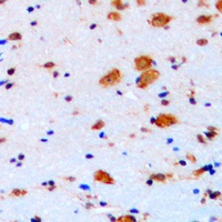 p27 Kip1 Rabbit Polyclonal Antibody
