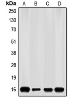 p16 INK4a Rabbit Polyclonal Antibody