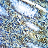 Anti-p16 INK4a Antibody