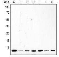 p14 ARF Rabbit Polyclonal Antibody