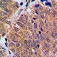 p18 INK4c Antibody
