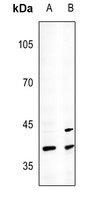 CDX2 Rabbit Polyclonal Antibody