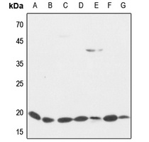Cofilin Rabbit Polyclonal Antibody