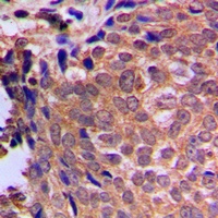 Anti-Cofilin Antibody