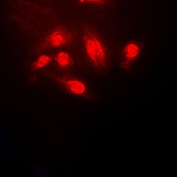 Anti-Cofilin Antibody