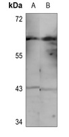 CHK1 (Phospho-S286) Antibody