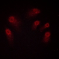 CHEK1 (phospho-S286) antibody