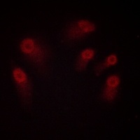 CHK1 (Phospho-S286) Antibody