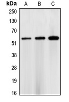 CHK1 Rabbit Polyclonal Antibody