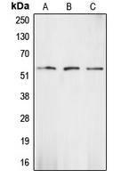CHK1 Rabbit Polyclonal Antibody