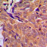 Anti-CHK1 Antibody