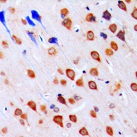 Anti-CHK1 Antibody