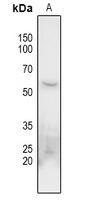 CHK1 Rabbit Polyclonal Antibody