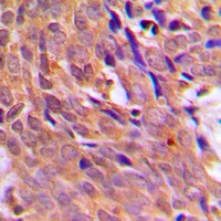Anti-CHK1 Antibody