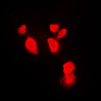 Anti-CHK1 Antibody