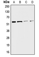 CHRNA3 Rabbit Polyclonal Antibody