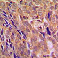IKK alpha Antibody