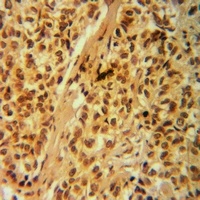 Anti-G18 Antibody