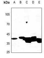 Creatine Kinase M Antibody