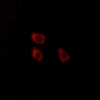 Anti-CLCN4 Antibody