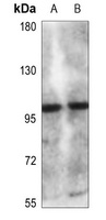 CLCN6 Antibody