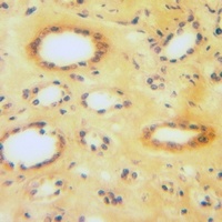 Anti-CLCN6 Antibody