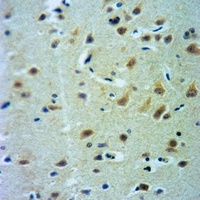 Anti-CLCN7 Antibody