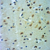 CLCN7 antibody