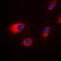 Anti-CLCN7 Antibody